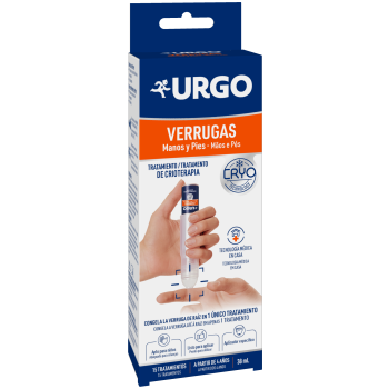 Verrugas Crioterapia